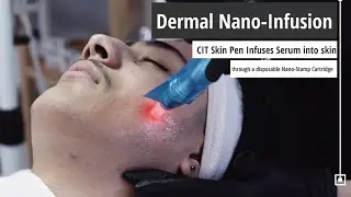 Dermal Nano-Infusion | Dallas Skin Care Specialists | Jewel Skin Studio