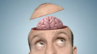 Fotomontáž - mozog odchádza