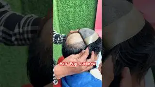 Hair Wigs In Lucknow Price List | 7355087241 | Hair Wig For Men In Lucknow #hairwig #lucknow