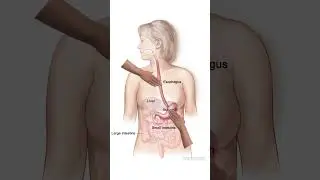 Visceral Manipulation for Hiatal Hernia #fasciarelease #visceralmanipulation #hiatalhernia #acidity