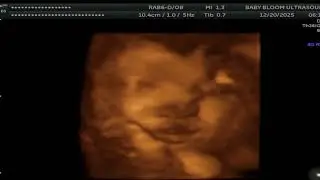 Baby Bloom Ultrasound Live Stream