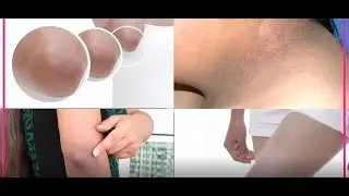 KEN whitening Cream | Whiten your dark Knees. Elbow & Neck | RevlukUAE | XieonLife