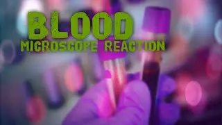 E08 Reaction To Blood Under a Microscope