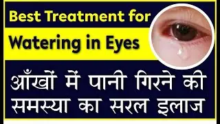 Cause of Watery eye in Children | Best treatment for watery eyes आँखो में पानी की समस्या का सरल इलाज