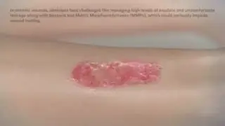 3M&trade; Kerramax Care&trade; Super-Absorbent Dressings Mode of Action and Application Video