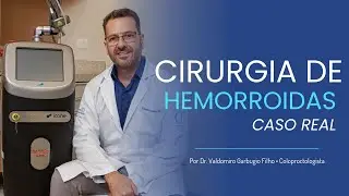 Cirurgia de Hemorroida a Laser- Caso real
