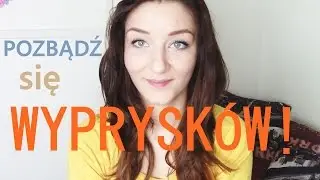 Jak pozbyć się wyprysków w 3 dni?! kajmanowa