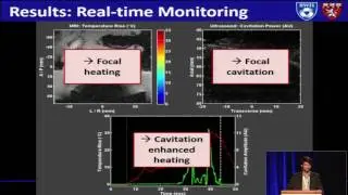 Crake - Acoustic mapping and MR thermometry for real-time multi-modality imaging of ablation (2016)