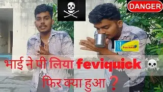 How to remove fevikwik From Skin।@MRINDIANHACKER ।#Howtoremovefeviquik