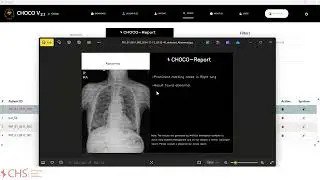 CHOCO AI - Video Tutorial ( V 2.3.0 )