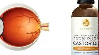 How to Use Castor Oil to Remove Cataracts and Improve Vision