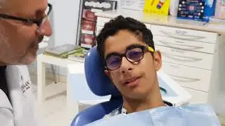 العمر الافضل لتقويم الاسنان (    سنة 12- 14 ) . Optimum Age for ortho trat