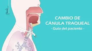Cambio de cánula traqueal para pacientes | Animación | Fahl Medizintechnik-Vertrieb GmbH