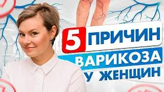 Почему появляется варикоз? 5 причин. Гинеколог Екатерина Волкова