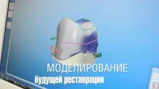 Клиника Ирины Беляевой CEREC Sirona hd720