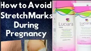 Luciara Cream Review Stretch Marks How to Avoid Stretch marks During Pregnancy easy method in telugu