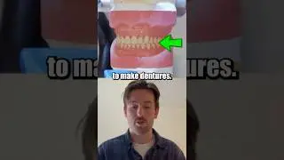 3D printed teeth! #viral #shorts #3d #3dprint #stem