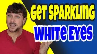 How To get Whiter Bright Eyes #shorts