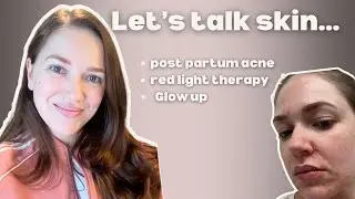 Let’s talk skin: post partum acne, red light therapy and glow up