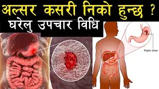 पेटमा अल्सर देखियो ? के खाने के नखाने ? यस्तो छ घरेलु उपचार विधी / Ulsar
