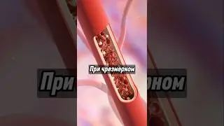 Чем опасен избыток витамина D для сердца? #здоровье #витамины