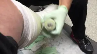 Soft Cast Off/Hard Cast On 👣👨&zwj;⚕️