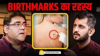 पिछले जन्म की छाप कैसे शरीर पर रह जाती है? | Birthmarks Secrets Explained by Gurpreet Arora
