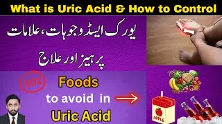 What is Uric Acid Hindi/Urdu | How to reduce Uric Acid Level by Foods by Dr Mudasir Saeed