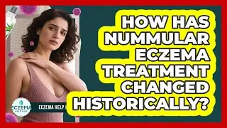How Has Nummular Eczema Treatment Changed Historically? - Eczema Help Hub