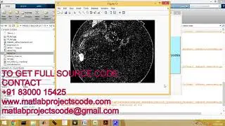 Retina image analysis for diabetic retinopathy diagnosis matlab projects code