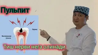 пульпит-тиш нерви