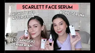 Review Scarlett Face Serum Untuk Jerawat & Mencerahkan Kulit | SHE&CAT