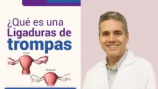 Qué es una ligadura de trompas l Dr. Juan Luis Giraldo
