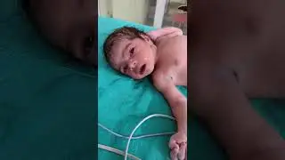 Baby cry#nursing #anmnursing #trending #vairalvideo #shortvideo