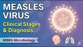Measles Virus Made Simple | Pathogenesis, Clinical Stages, Complications & Lab Diagnosis | MBBS