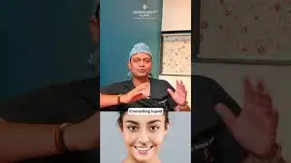 Know your skin type in 5 simple steps with Dr. Prashant! Follow Dermadent for skincare tips.