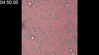 Time lapse imaging of 3wj Balpha9 in live cells(MDA-MB-231)