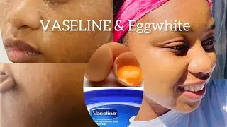 Clear skin Using Vaseline and Egg white -Asian Anti-Aging secrets