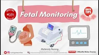 Fetal Monitoring Nclex Quick Tips