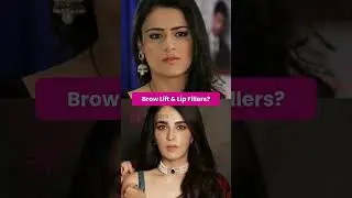 😱 👉 Radhika Madan Plastic Surgery Transformation | Before & After Shocking Change 2025! #explore