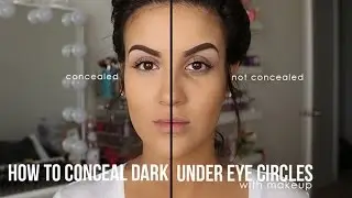 How to Conceal Dark Under Eyes With Makeup