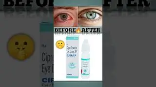 ciplox eye drop 😱 #shorts #eyecare #viral