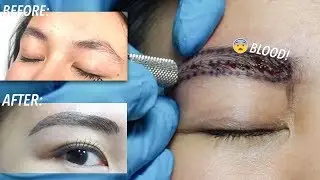 Getting My Eyebrows Microbladed &mdash; VERY AFFORDABLE! (Whole Procedure & Tips!!) | Philippines