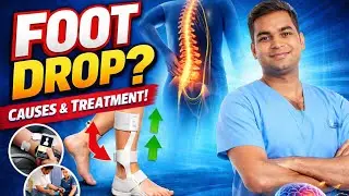 Foot Drop को Ignore न करें! How to Fix Foot Drop Fast
