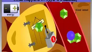 diabetesvideo