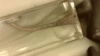 Retratamento protaper-desobstrução