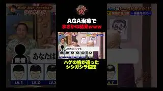 【予想外のオチ】AGA治療でまさかの&ldquo;ハゲ格差&rdquo;ｗｗｗ#shorts