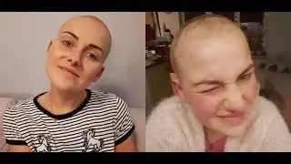 POKAŻE WAM MÓJ GUZ NOWOTWOROWY😱😱😱KONTROLA NA ONKOLOGII😥