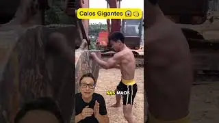 Calos Gigantes 😱👊 #curiosidades #medico #medicina #enfermagem #enfermeira #saude #sa&uacute;de #treino