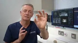 What Are Dental Implants? | 7oaks Advanced Dental Implant Clinic